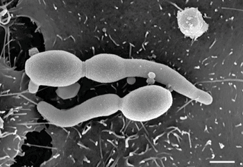 Image: Electron micrograph of Candida albicans (Photo courtesy of the Robert Koch Institute).